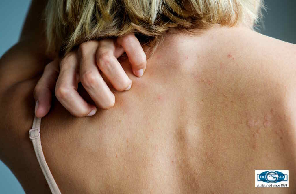 Eczema Cotton Gloves