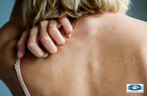 Eczema Cotton Gloves